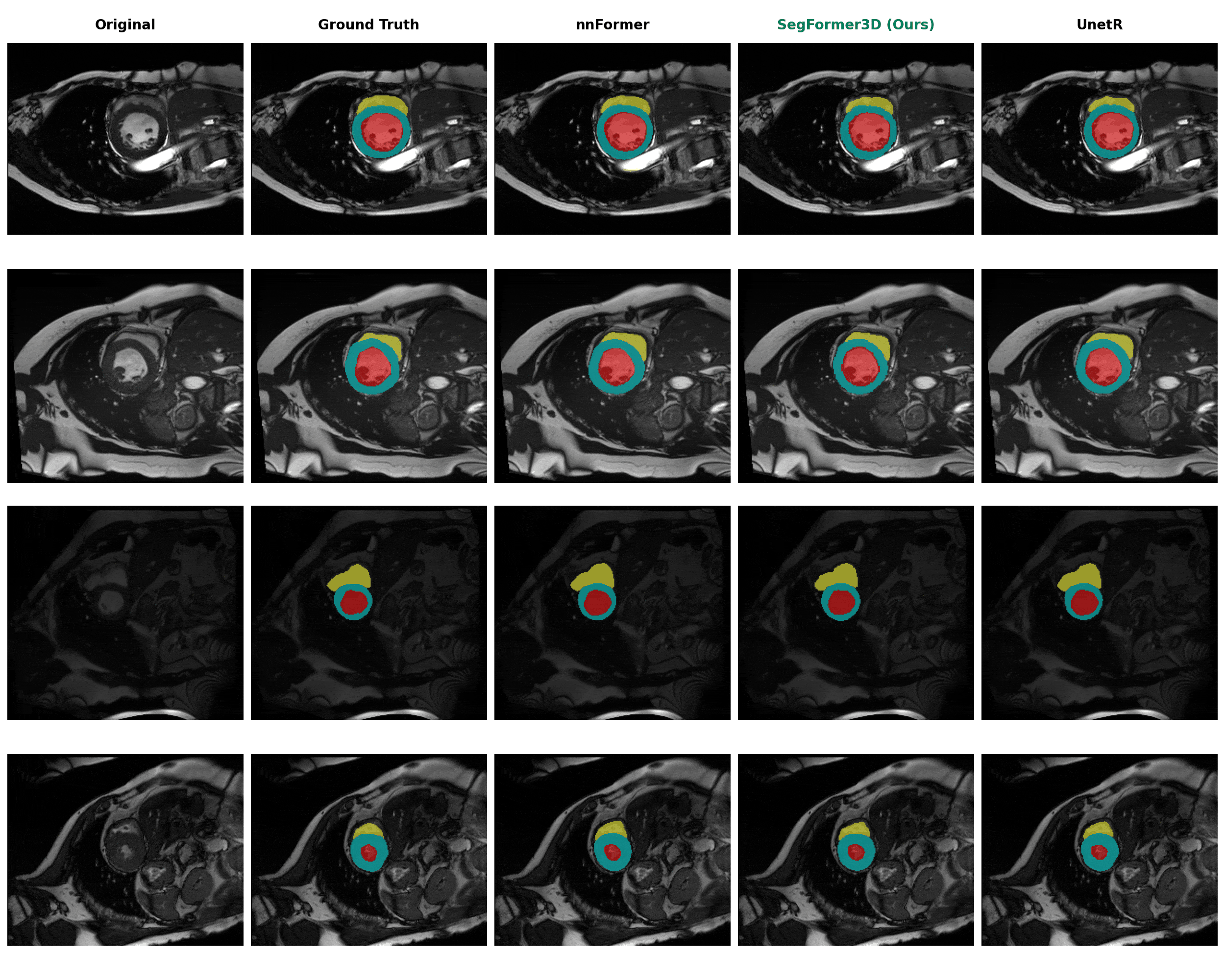 ACDC Segmentation Results