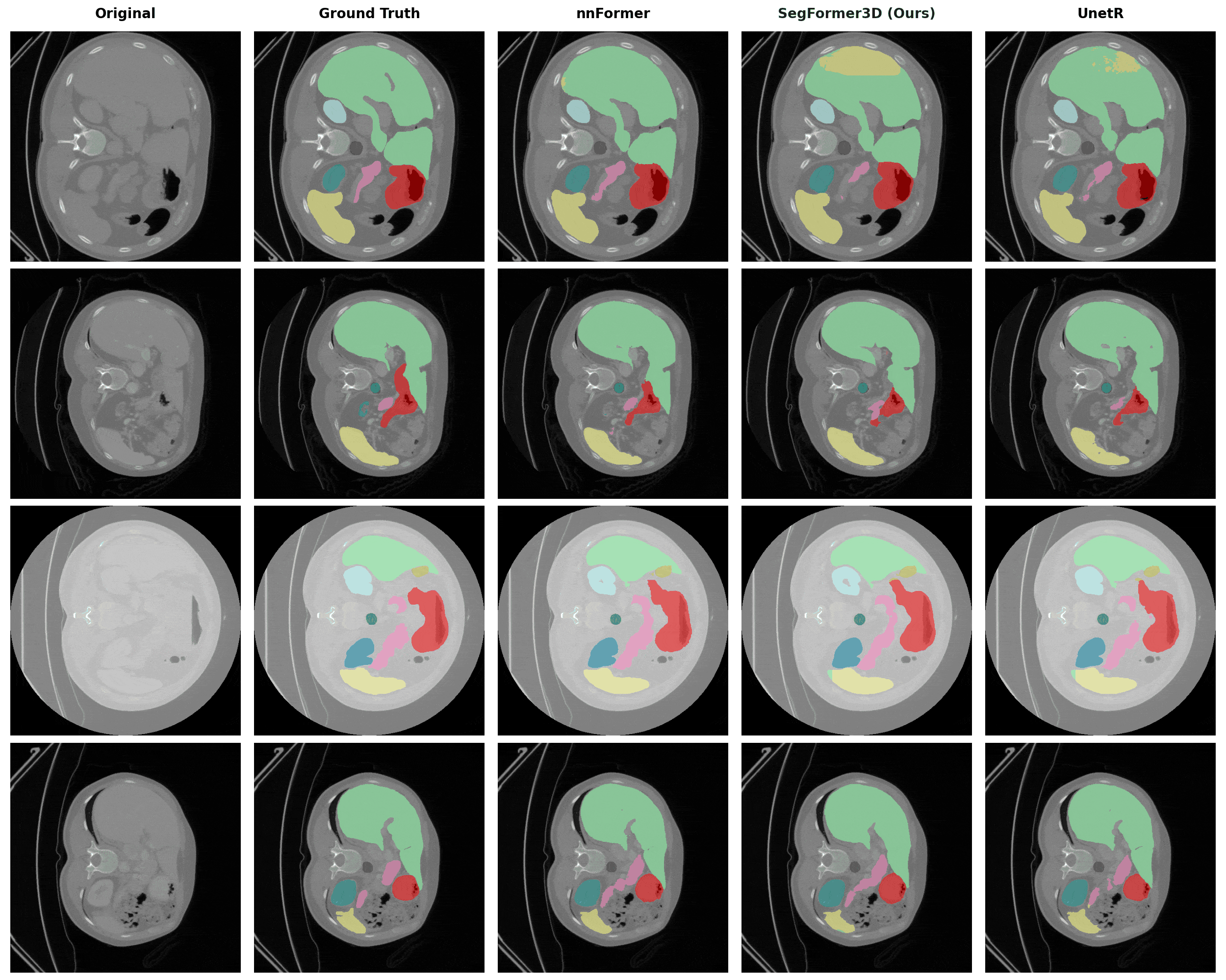 Synapse Segmentation Results
